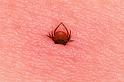 Ixodes_ricinus_D5037_Z_90_Les Gris_Frankrijk